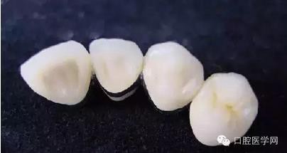 大部分牙医都不知道的义齿生产详细流程!